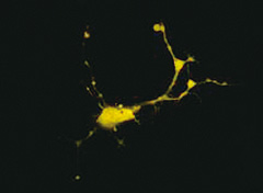 Expression of yellow fluorescence protein-tagged molecule in neuronal cells