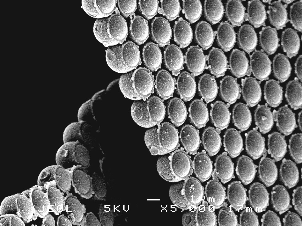Electron micrograph of advanced polymeric film
