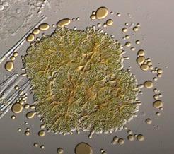 Microscopic view of a hydrocarbon-producing microalga, Botryococcus braunii.